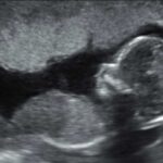 Frauenarztpraxis Tamkan Ultraschalldiagnostik